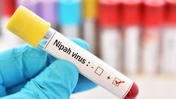 Nipah virus