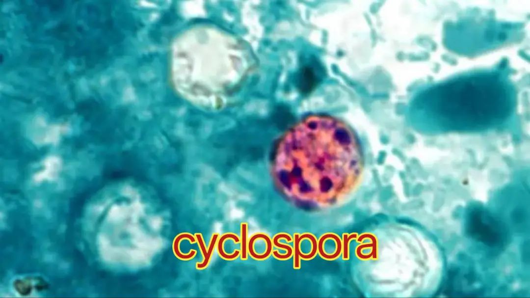 Cyclospora Outbreak 2026 Cyclospora Outbreak 2026
